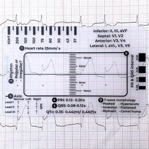 MediTrack – Professional ECG Assessment Pocket Guide