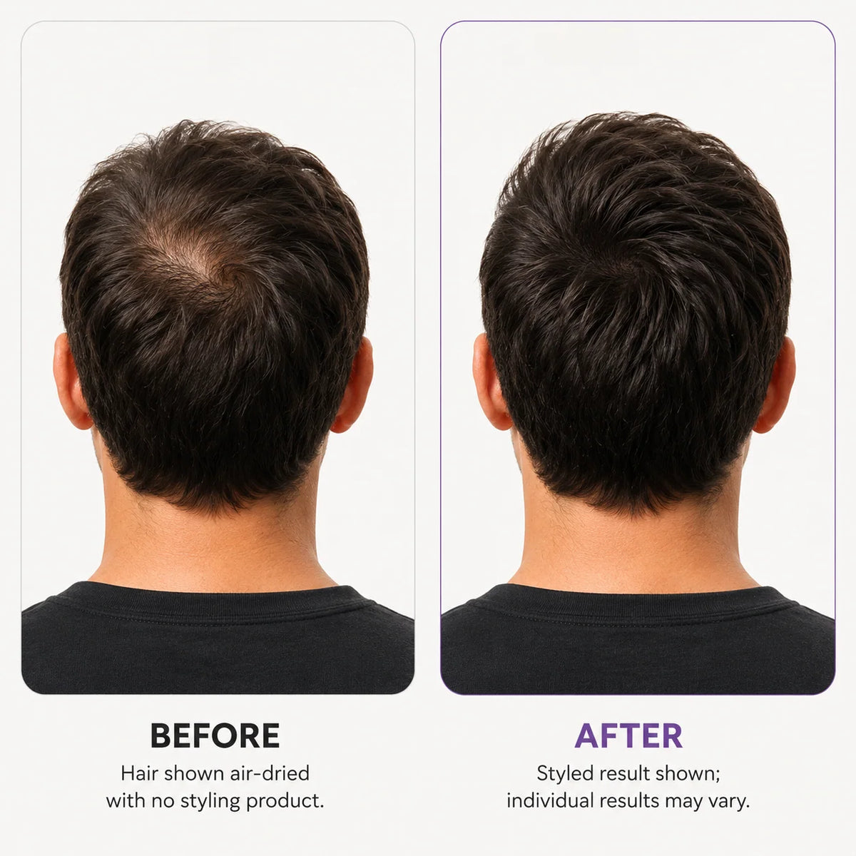 FoliVelle – Scalp Revitalizing Hair Thickening Roll-On Serum