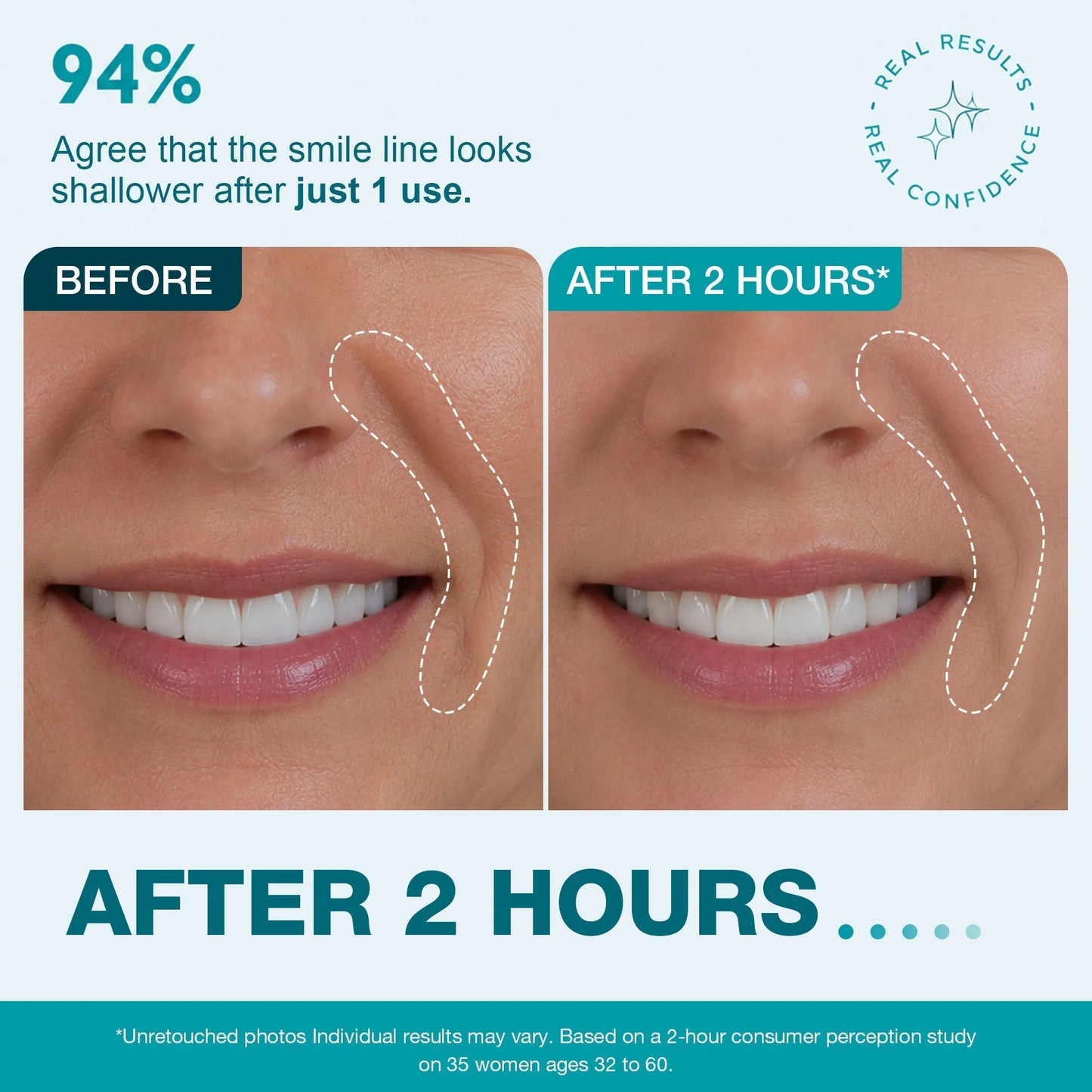 SmoothLuxe – Peptide Powered Facial Smoothing Tape