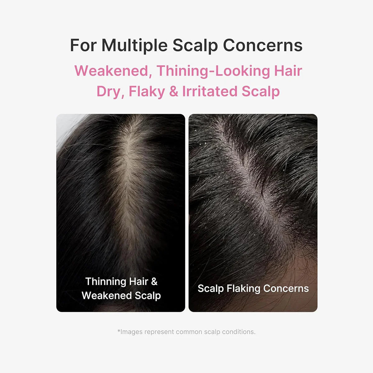 ScalpRevive – PDRN Spicule Root Care Treatment