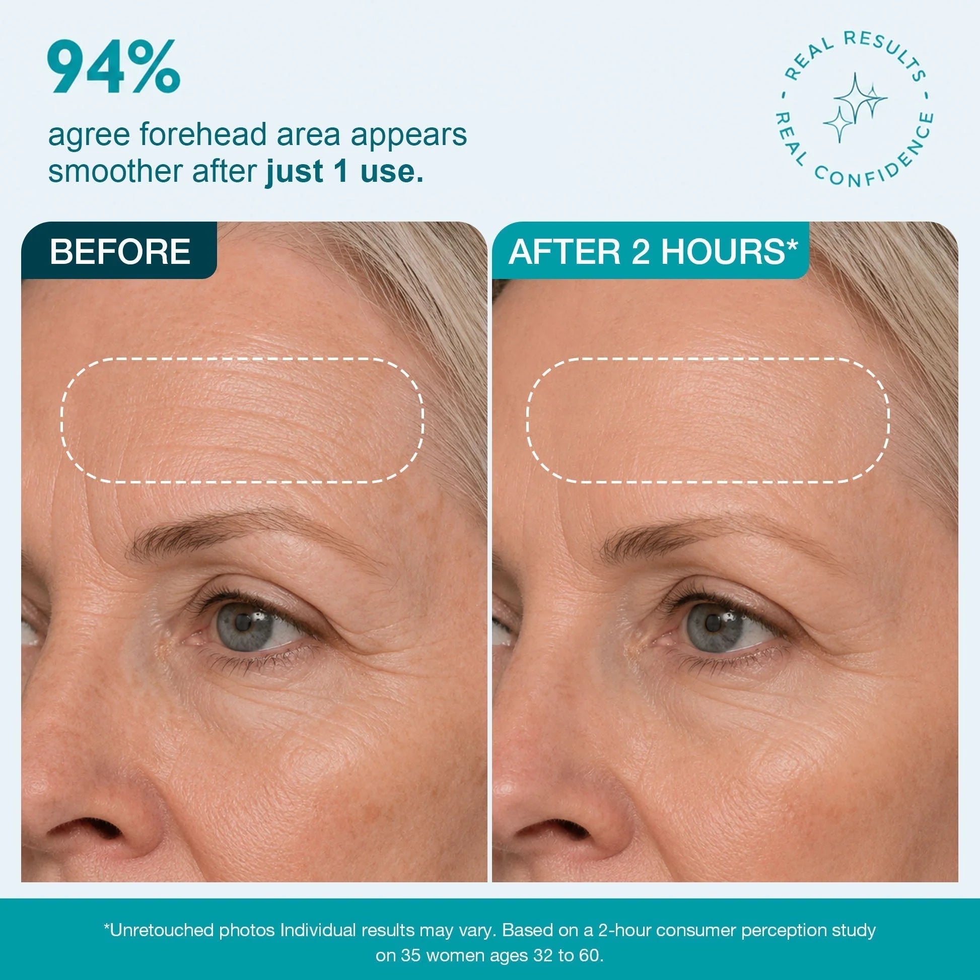 SmoothLuxe – Peptide Powered Facial Smoothing Tape