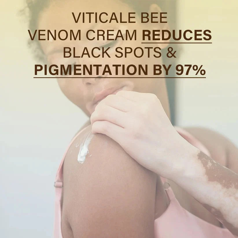 VitiClear – Bee Venom Botanical Pigment Balancing Cream