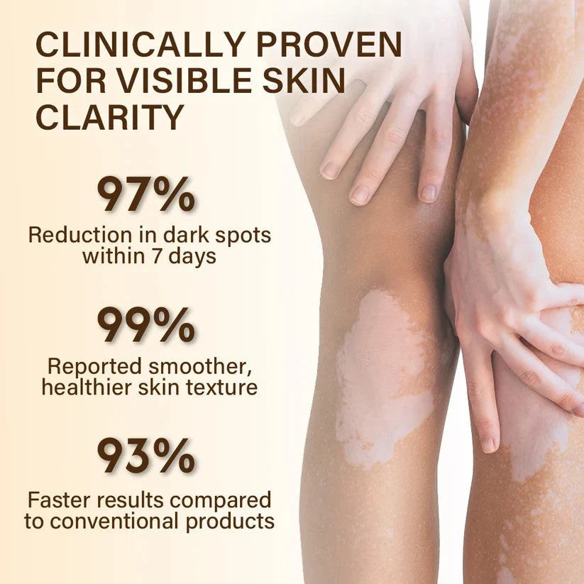 VitiClear – Bee Venom Botanical Pigment Balancing Cream