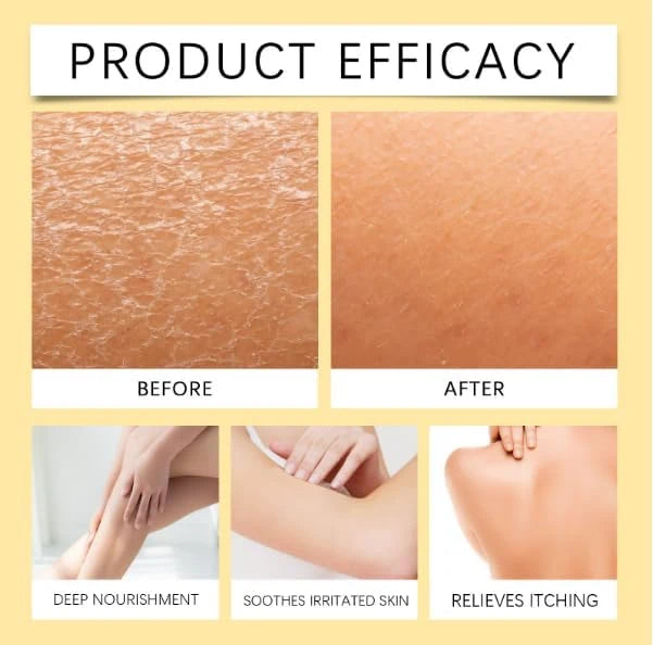 VitiClear – Bee Venom Botanical Pigment Balancing Cream