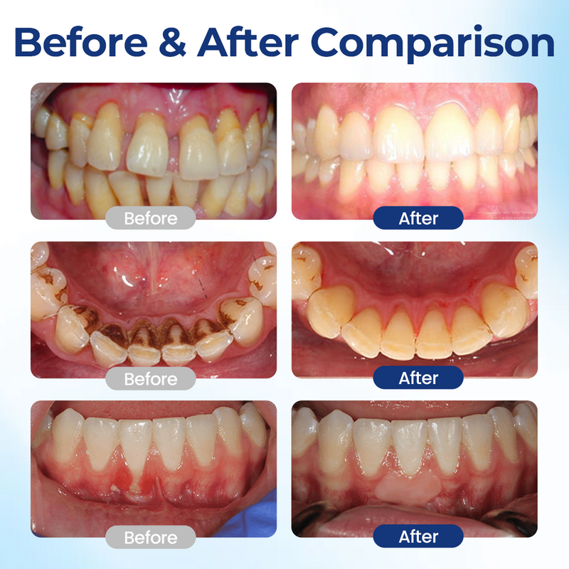 BeeTakt – Advanced Oral Repair Solution
