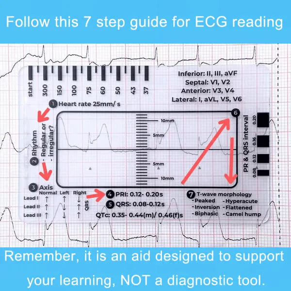 MediTrack – Professional ECG Assessment Pocket Guide