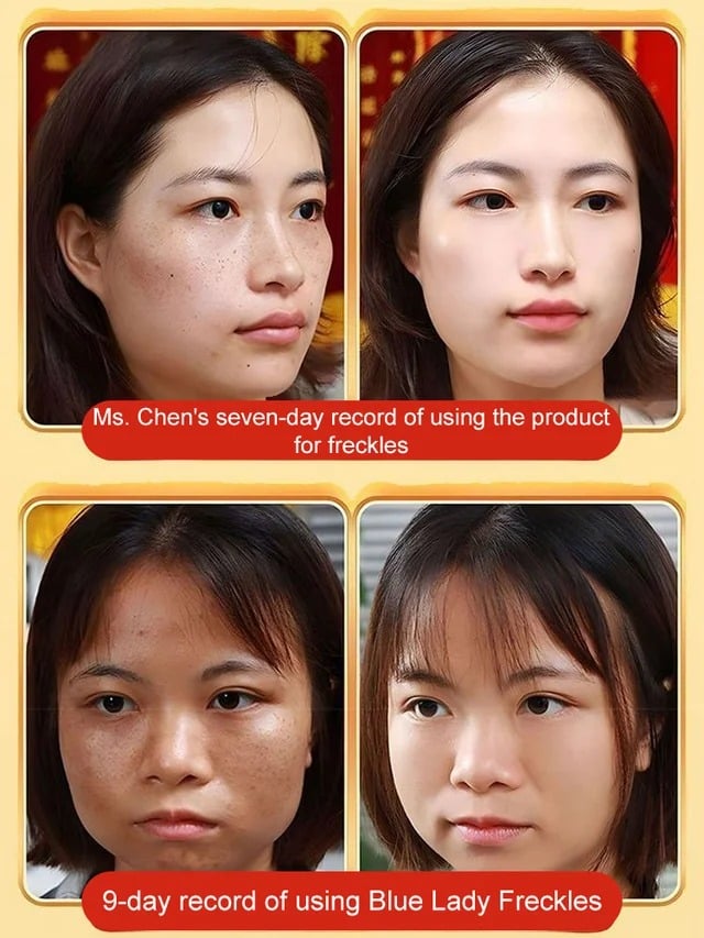 Blemish removal, whitening and beauty water