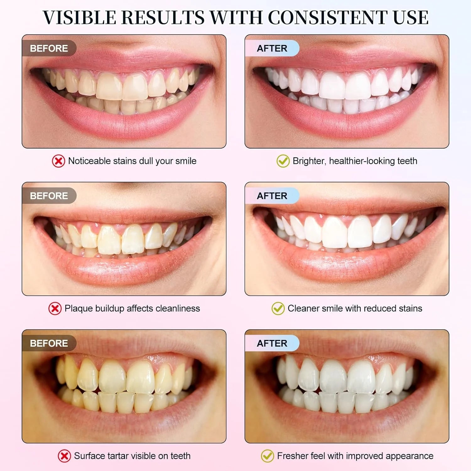 Niacinamide Whitening Toothpaste – Stain Removal & Fresh Breath