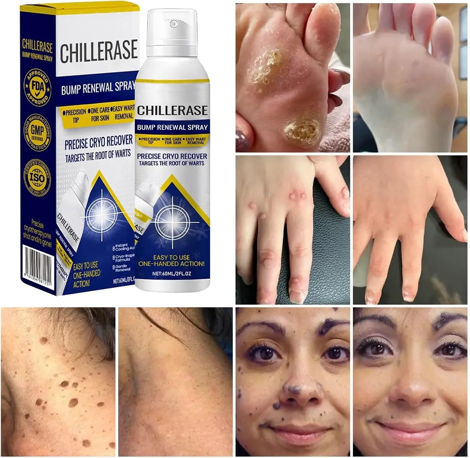 ChillErase – Smooth Skin Renewal Spray