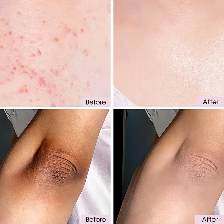 GlowRenew – Advanced Exfoliating Brightening Spray
