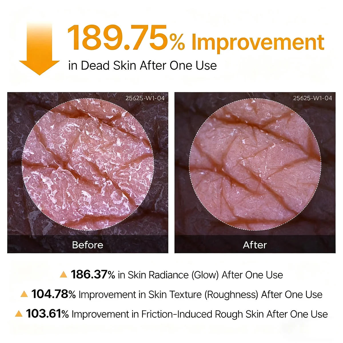 GlowPeel – Keratin Care Kojic Acid Turmeric Body Peeling Spray