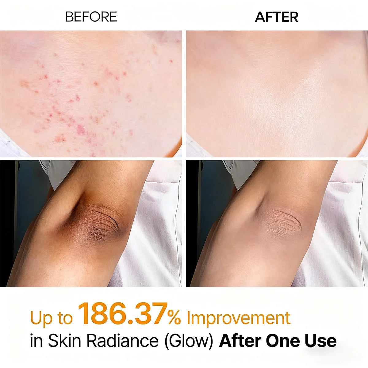 GlowPeel – Keratin Care Kojic Acid Turmeric Body Peeling Spray