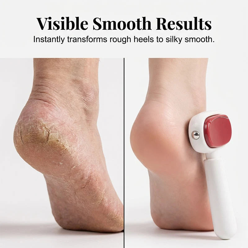 SoleVera – Double-Sided Stainless Steel Foot Scraper