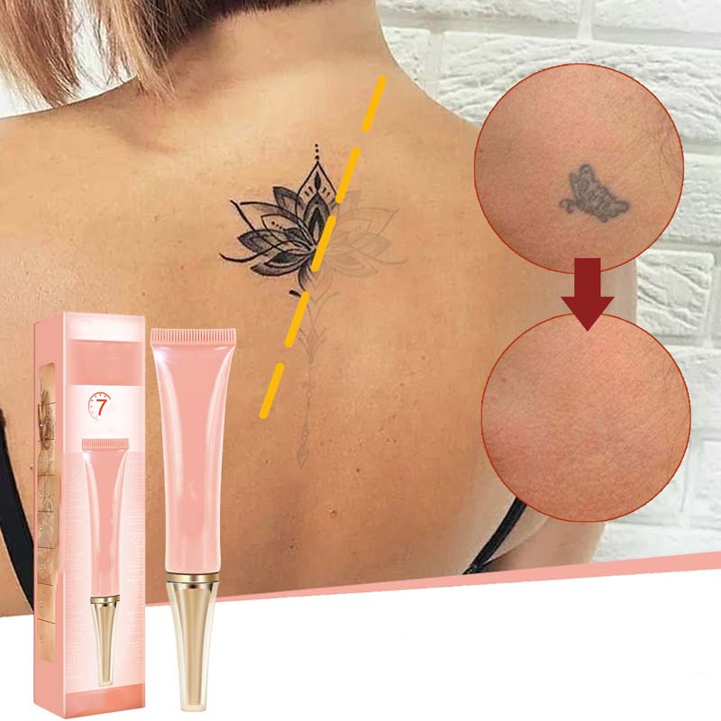 FadeEase – Gentle Tattoo Fading Cream