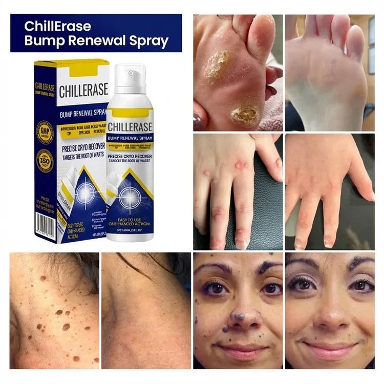 ChillErase – Smooth Skin Renewal Spray