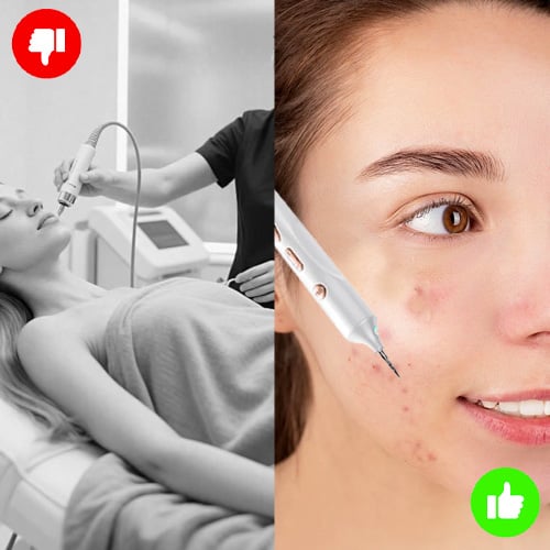 LumiSkin – Plasma Beauty Pen