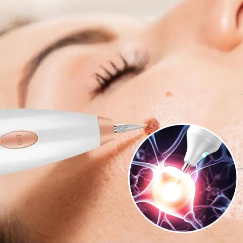 LumiSkin – Plasma Beauty Pen