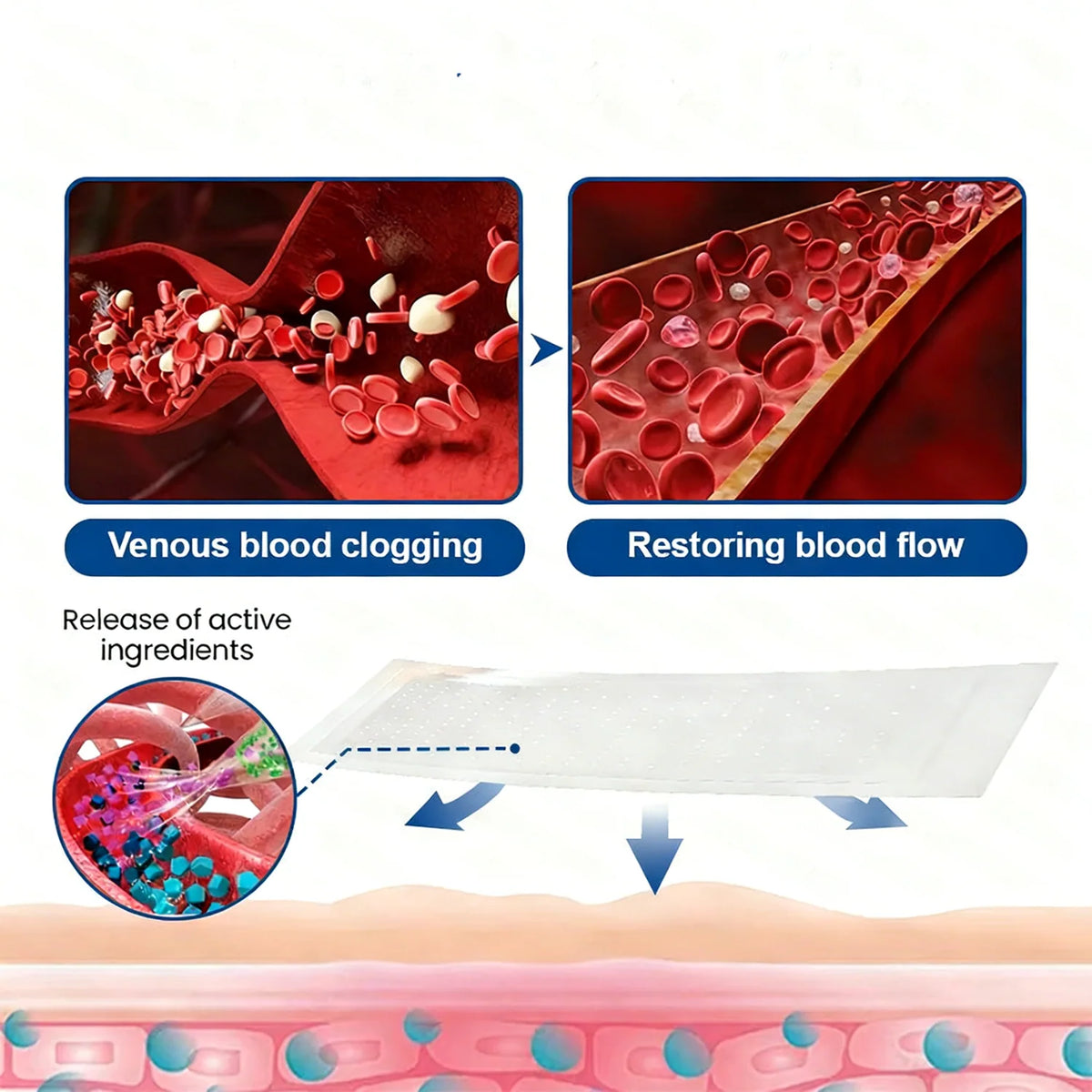 VenoLume – Diosmin & Hesperidin Microneedle Vein Patch