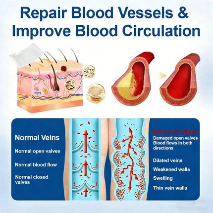 VenoLume – Diosmin & Hesperidin Microneedle Vein Patch